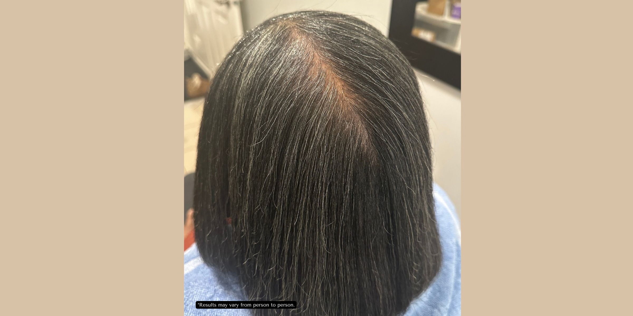 Before treatment